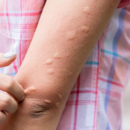 El truco definitivo para librarte de los mosquitos en verano: así debes utilizar la canela según la experiencia de esta abuela