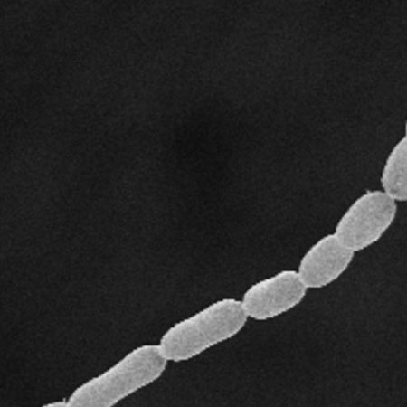 Misterio resuelto 1500 años después: identifican el patógeno que desató la primera pandemia de la historia