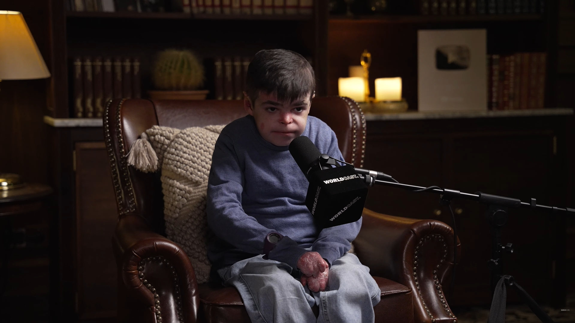 Piel de Mariposa: El Grito Silencioso de Leo que Conmueve Europa