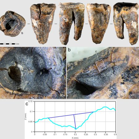 ¡Sorpresa Paleolítica! Descubren en Siberia el Tratamiento Dental Más Antiguo del Mundo